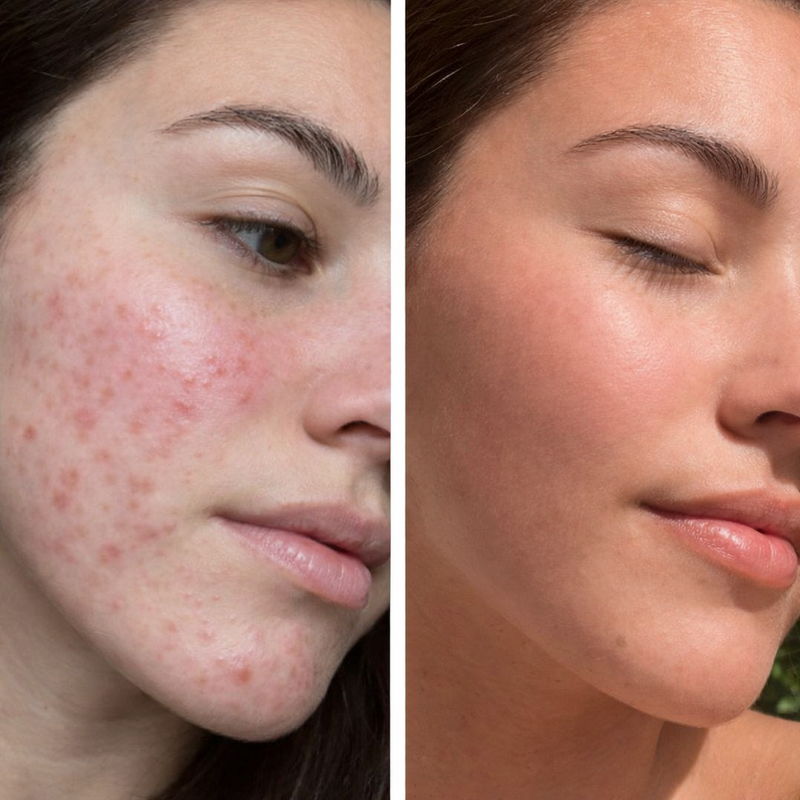 Before and After result